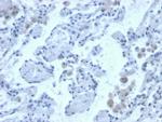 Cystatin B Antibody in Immunohistochemistry (Paraffin) (IHC (P))