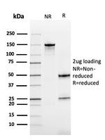 Cystatin B Antibody in SDS-PAGE (SDS-PAGE)