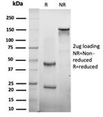 CTBP2 (C-terminal binding protein 2) Antibody in SDS-PAGE (SDS-PAGE)