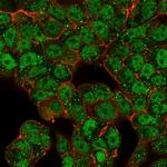 CTBP2 (C-terminal binding protein 2) Antibody in Immunocytochemistry (ICC/IF)