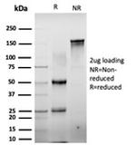 CTBP2 (C-terminal binding protein 2) Antibody in SDS-PAGE (SDS-PAGE)