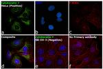 Cytokeratin 7 Antibody in Immunocytochemistry (ICC/IF)