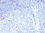 CTLA4/CD152 (Negative Regulator of T-Cells) Antibody in Immunohistochemistry (Paraffin) (IHC (P))