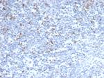 CTLA4/CD152 (Negative Regulator of T-Cells) Antibody in Immunohistochemistry (Paraffin) (IHC (P))