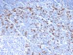 CTLA4/CD152 (Negative Regulator of T-Cells) Antibody in Immunohistochemistry (Paraffin) (IHC (P))