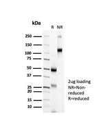 CTLA4/CD152 (Negative Regulator of T-Cells) Antibody in SDS-PAGE (SDS-PAGE)