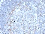 CTLA4/CD152 (Negative Regulator of T-Cells) Antibody in Immunohistochemistry (Paraffin) (IHC (P))