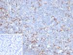 CTLA4/CD152 (Negative Regulator of T-Cells) Antibody in Immunohistochemistry (Paraffin) (IHC (P))