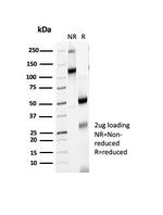 CTLA4/CD152 (Negative Regulator of T-Cells) Antibody in SDS-PAGE (SDS-PAGE)