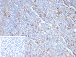 CTLA4/CD152 (Negative Regulator of T-Cells) Antibody in Immunohistochemistry (Paraffin) (IHC (P))