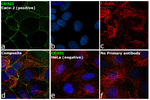 CD321 (F11R) Antibody