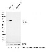 alpha-Fetoprotein Antibody in Western Blot (WB)