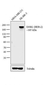 ErbB2 (HER-2) Antibody in Western Blot (WB)