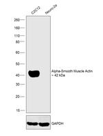 Alpha-Smooth Muscle Actin Antibody