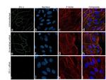 ZO-1 Antibody