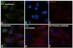 Fibronectin Antibody in Immunocytochemistry (ICC/IF)