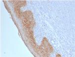 Catenin, beta (p120) Antibody in Immunohistochemistry (Paraffin) (IHC (P))