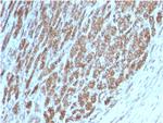 Catenin, beta (p120) Antibody in Immunohistochemistry (Paraffin) (IHC (P))