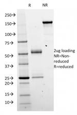 Catenin, beta (p120) Antibody in SDS-PAGE (SDS-PAGE)