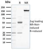 Catenin, beta (p120) Antibody in SDS-PAGE (SDS-PAGE)