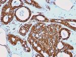 Catenin, beta (p120) Antibody in Immunohistochemistry (Paraffin) (IHC (P))