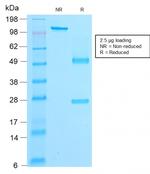 Catenin, beta (p120) Antibody in SDS-PAGE (SDS-PAGE)