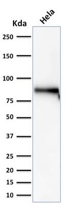 Catenin, beta (p120) Antibody in Western Blot (WB)