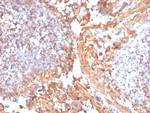 Catenin, beta (p120) Antibody in Immunohistochemistry (Paraffin) (IHC (P))