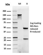 Catenin, beta (p120) Antibody in SDS-PAGE (SDS-PAGE)