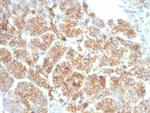 Catenin, beta (CTNNB1) Antibody in Immunohistochemistry (Paraffin) (IHC (P))