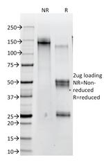 Catenin, beta (p120) Antibody in SDS-PAGE (SDS-PAGE)