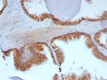 Catenin, beta (CTNNB1) Antibody in Immunohistochemistry (Paraffin) (IHC (P))