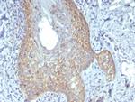 Catenin, beta (CTNNB1) Antibody in Immunohistochemistry (Paraffin) (IHC (P))