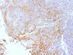 Catenin, beta (p120) Antibody in Immunohistochemistry (Paraffin) (IHC (P))