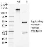 Catenin, beta (p120) Antibody in SDS-PAGE (SDS-PAGE)