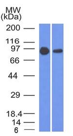 Catenin, beta (p120) Antibody in Western Blot (WB)