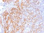 Catenin, beta (p120) Antibody in Immunohistochemistry (Paraffin) (IHC (P))