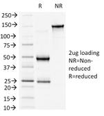 Catenin, beta (p120) Antibody in SDS-PAGE (SDS-PAGE)