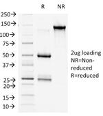 Catenin, beta (p120) Antibody in SDS-PAGE (SDS-PAGE)