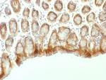 Catenin, beta (p120) Antibody in Immunohistochemistry (Paraffin) (IHC (P))