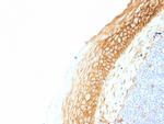 Catenin, beta (p120) Antibody in Immunohistochemistry (Paraffin) (IHC (P))