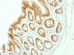 Catenin, beta (p120) Antibody in Immunohistochemistry (Paraffin) (IHC (P))