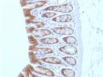 Catenin, beta (p120) Antibody in Immunohistochemistry (Paraffin) (IHC (P))