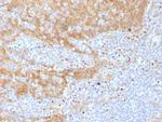 Catenin, beta (p120) Antibody in Immunohistochemistry (Paraffin) (IHC (P))