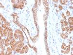 Catenin, beta (p120) Antibody in Immunohistochemistry (Paraffin) (IHC (P))