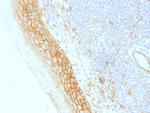 Catenin, beta (p120) Antibody in Immunohistochemistry (Paraffin) (IHC (P))