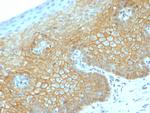 Catenin, beta (p120) Antibody in Immunohistochemistry (Paraffin) (IHC (P))