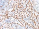 Catenin, beta (p120) Antibody in Immunohistochemistry (Paraffin) (IHC (P))