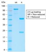 Catenin, beta (p120) Antibody in SDS-PAGE (SDS-PAGE)