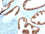 Catenin, beta (CTNNB1) Antibody in Immunohistochemistry (Paraffin) (IHC (P))